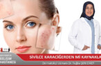 SİVİLCE KARACİĞERDEN Mİ KAYNAKLANIR?