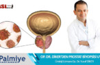 OP. DR. YUSUF DİKER’DEN PROSTAT BİYOPSİSİ UYARISI