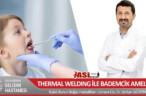 THERMAL WELDING İLE BADEMCİK AMELİYATI