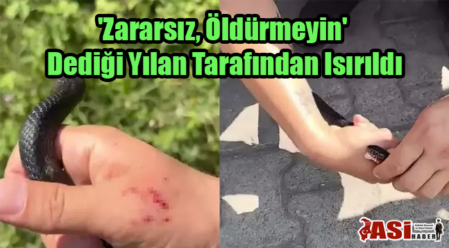 ‘Zararsız, Öldürmeyin’ Dediği Yılan Tarafından Isırıldı